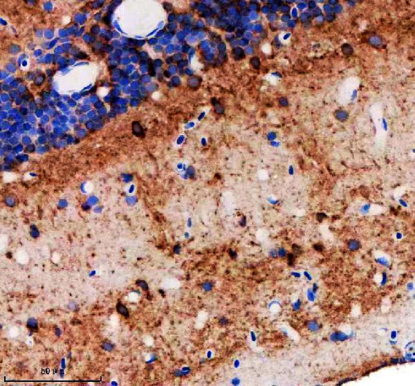 azf1qmf9 nedd8 8l primary antibodies ihc testing 1