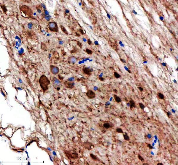 azf1qmf9 nedd8 8l primary antibodies ihc testing 2