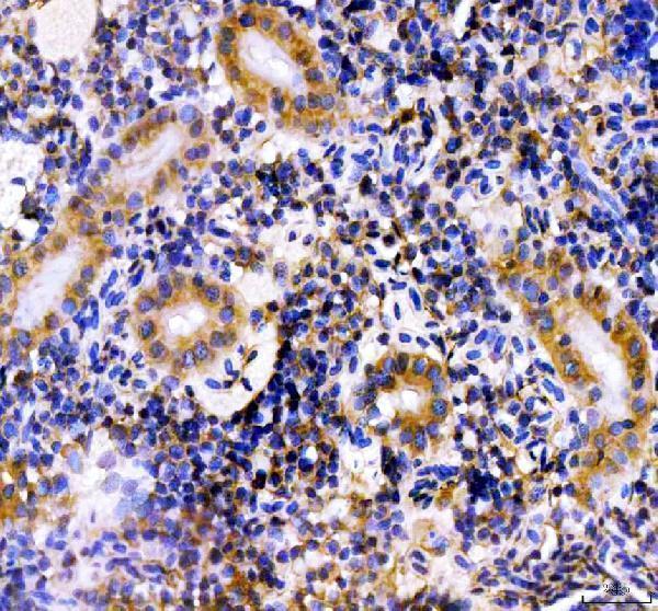 IHC analysis of HSD3B1 using anti-HSD3B1 antibody (AZF1QSA2)