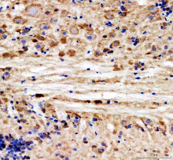 IHC analysis of HSD3B1 using anti-HSD3B1 antibody (AZF1QSA2)