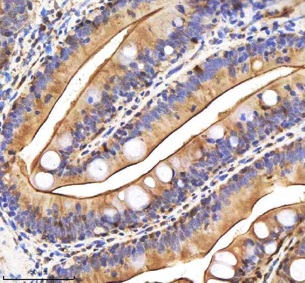 azf1qsb1 caspase 9 casp9 primary antibodies ihc testing 5