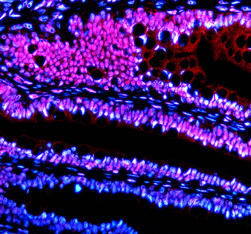 azf1qu76 cyp7a1 primary antibodies if testing 3