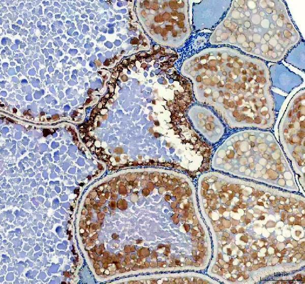IHC analysis of HSD17B1 using anti-HSD17B1 antibody (AZF1QUP2)