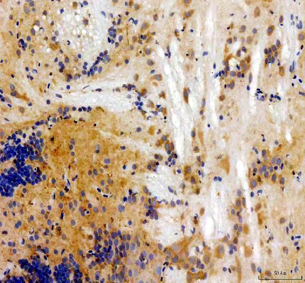 IHC analysis of HSD17B1 using anti-HSD17B1 antibody (AZF1QUP2)
