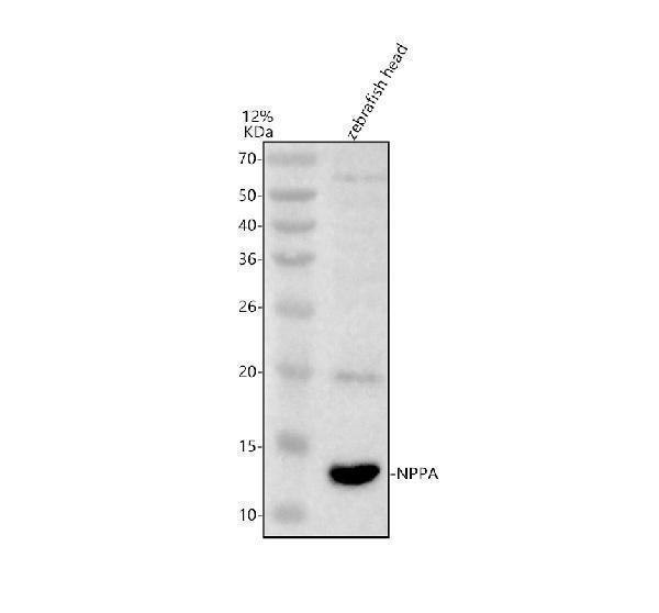 Western blot analysis of NPPA using anti-NPPA antibody (AZF1QVW0)