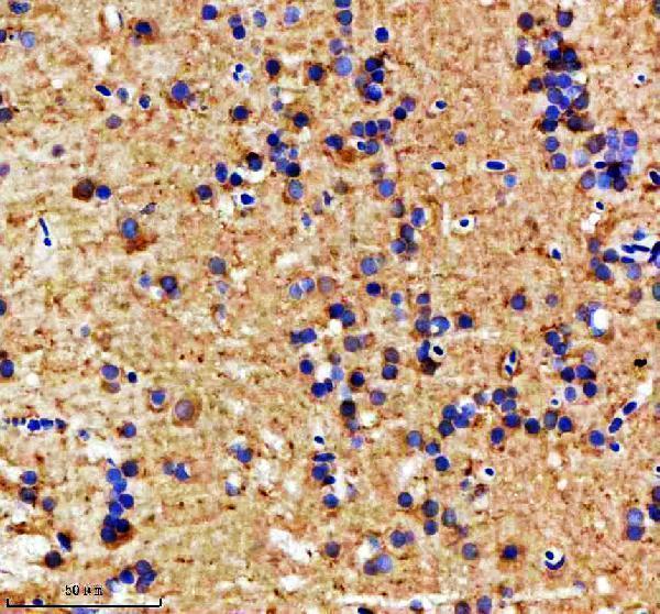 azf1qyu7 mat2aa b primary antibodies ihc testing 2