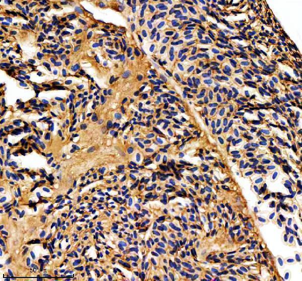 azf1qyu7 mat2aa b primary antibodies ihc testing 3