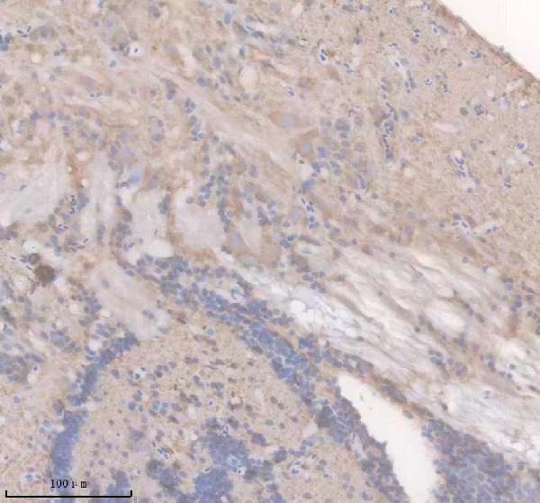 azf1r0a8 syn2a primary antibodies ihc testing 1