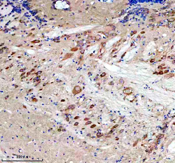 azf1r166 eif4a2 primary antibodies ihc testing 3