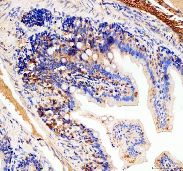 IHC analysis of EIF4A2 using anti-EIF4A2 antibody (AZF1R166)