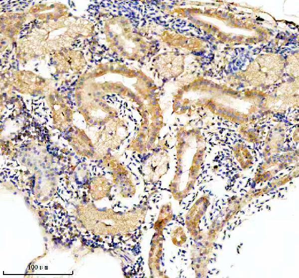  IHC analysis of EIF4A2 using anti-EIF4A2 antibody (AZF1R166)