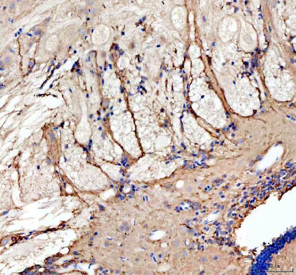 azf1r366 grin1a b primary antibodies ihc testing 1