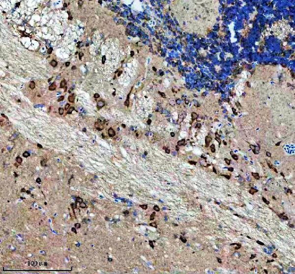  IHC analysis of NOVA2 using anti-NOVA2 antibody (AZF1R4G7)