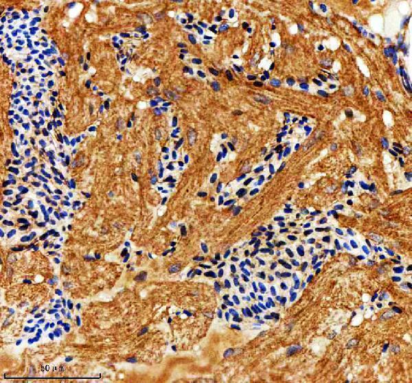  IHC analysis of NOVA2 using anti-NOVA2 antibody (AZF1R4G7)