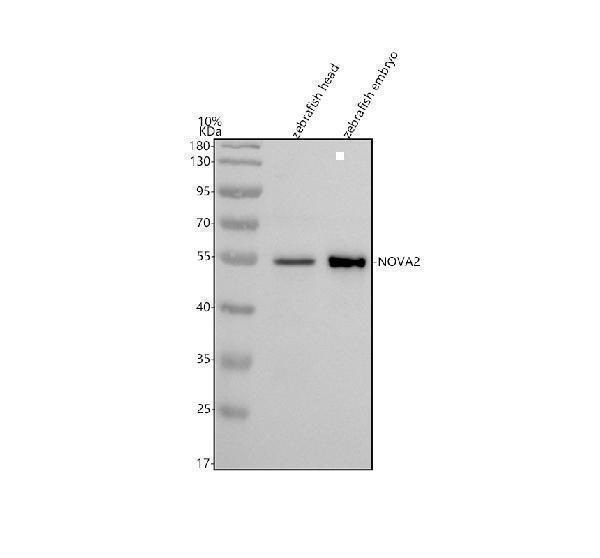  Western blot analysis of NOVA2 using anti-NOVA2 antibody (AZF1R4G7)