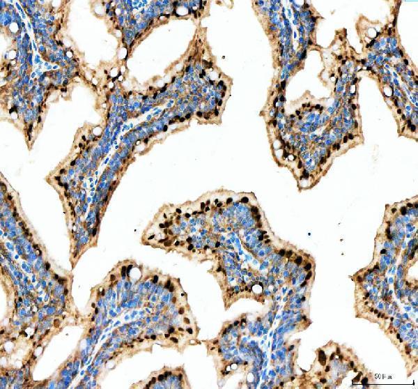  IHC analysis of METTL3 using anti-METTL3 antibody (AZF1R777)
