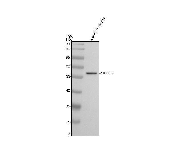  Western blot analysis of METTL3 using anti-METTL3 antibody (AZF1R777)