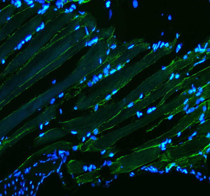 azf1r8w4 desma primary antibodies if testing 1