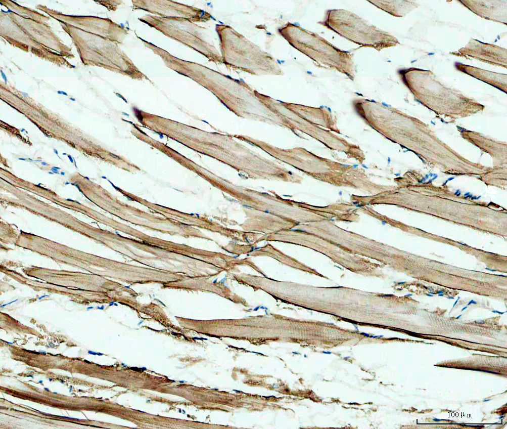 azf1r8w4 desma primary antibodies ihc testing 1