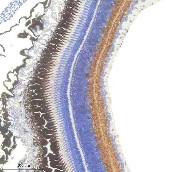 IHC analysis of GAD2 using anti-GAD2 antibody (AZF1R9E8)