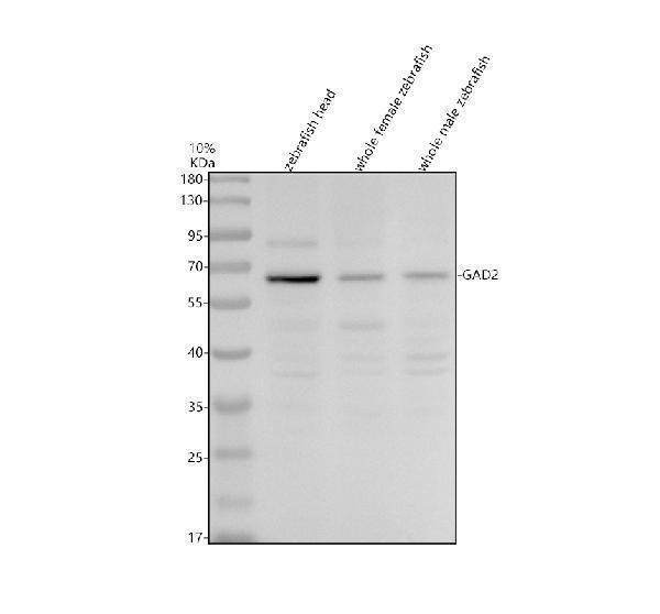 Western blot analysis of GAD2 using anti-GAD2 antibody (AZF1R9E8)