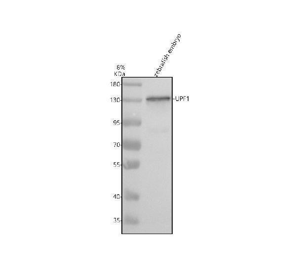 Western blot analysis of UPF1 using anti-UPF1 antibody (AZF1RCY6)