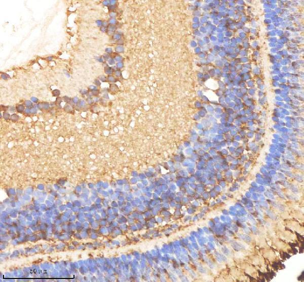 IHC analysis of OAT using anti-OAT antibody (AZF8W5L3)