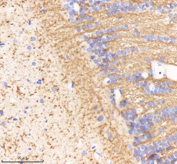 IHC analysis of OAT using anti-OAT antibody (AZF8W5L3)