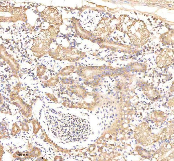 IHC analysis of OAT using anti-OAT antibody (AZF8W5L3)