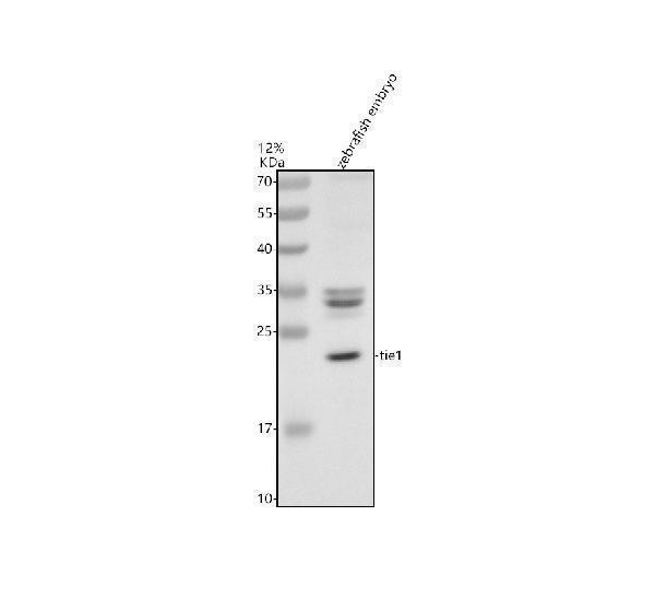 Western blot analysis of TIE1 using anti-TIE1 antibody (AZG1K2H0)
