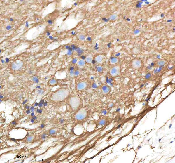azo13144 ndr1 primary antibodies ihc testing 3