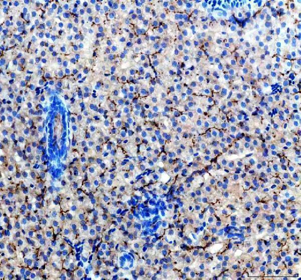 azo73736 acvr1l primary antibodies ihc testing 1