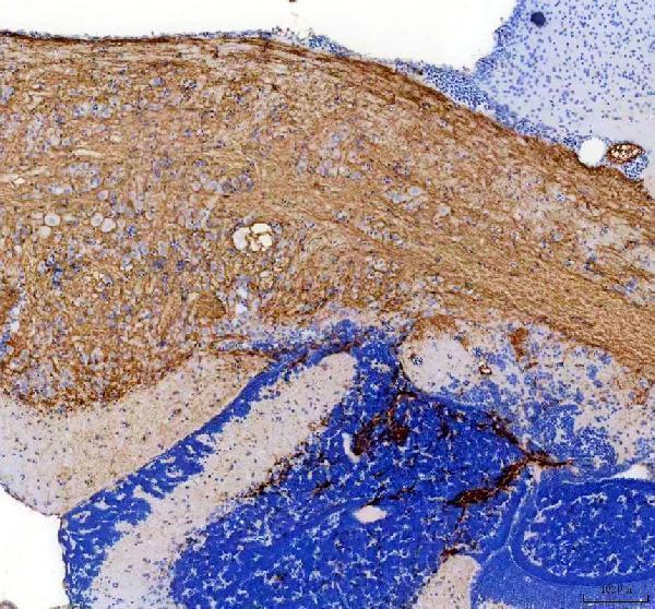 azo73736 acvr1l primary antibodies ihc testing 2