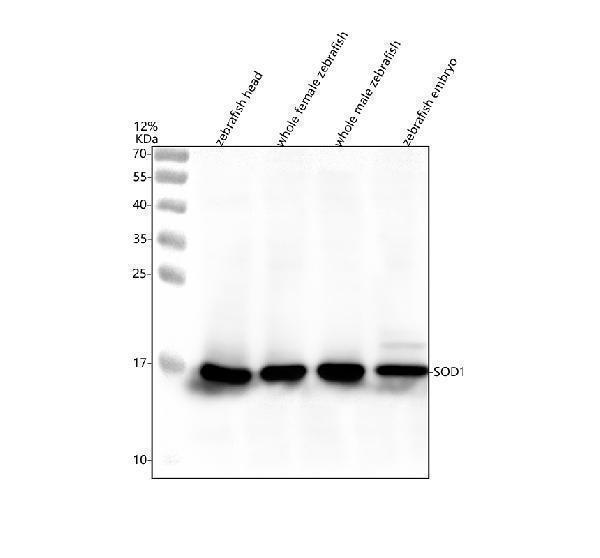  Western blot analysis of SOD1 using anti-SOD1 antibody (AZO73872)