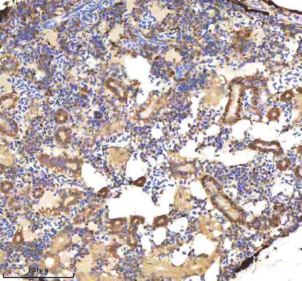 azo93369 bmp2b primary antibodies ihc testing 3