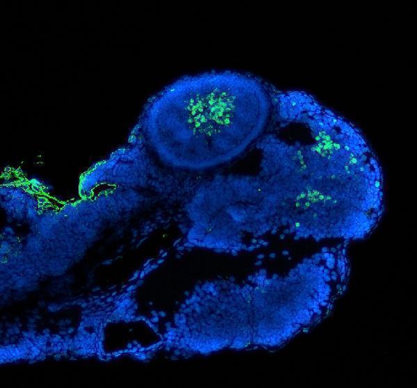azp26630 pax6 a b primary antibodies if testing 1