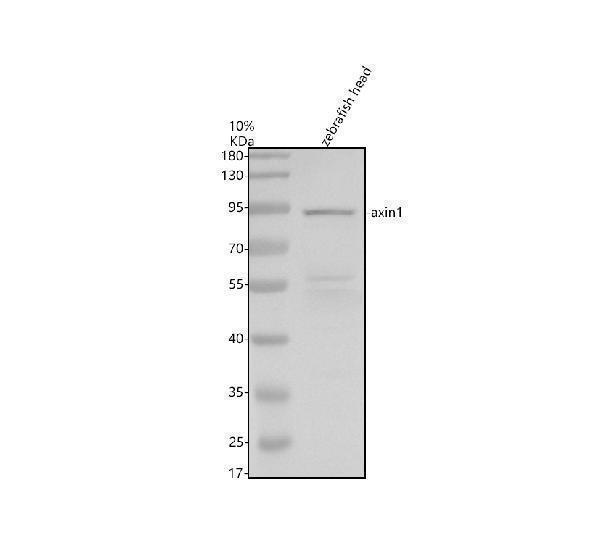 Western blot analysis of AXIN1 using anti-AXIN1 antibody (AZP57094)
