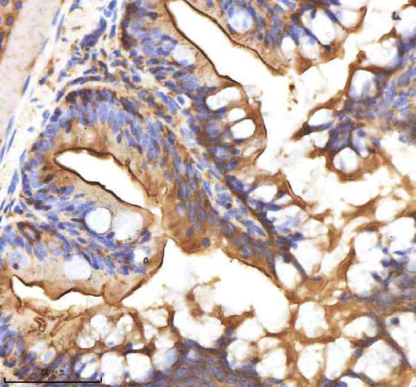  IHC analysis of AXIN2 using anti-AXIN2 antibody (AZP57095)