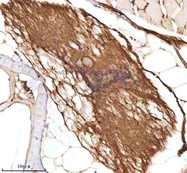  IHC analysis of AXIN2 using anti-AXIN2 antibody (AZP57095)
