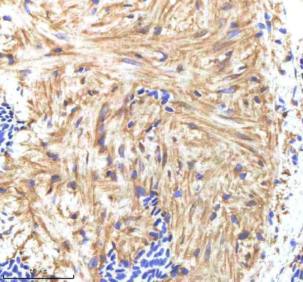  IHC analysis of HAND2 using anti-HAND2 antibody (AZP57102)