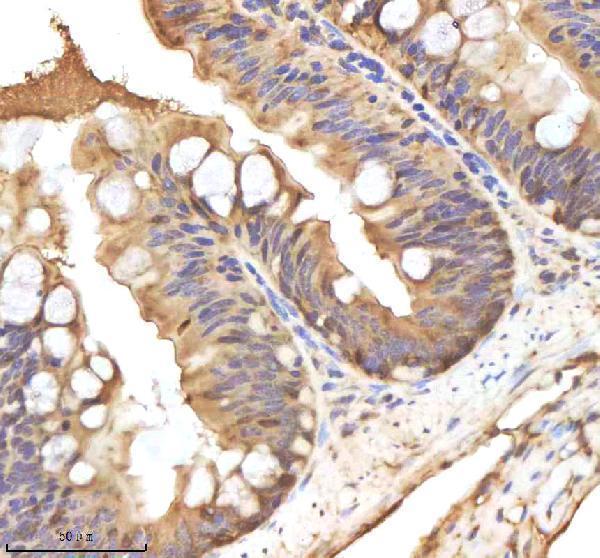 IHC analysis of HAND2 using anti-HAND2 antibody (AZP57102)