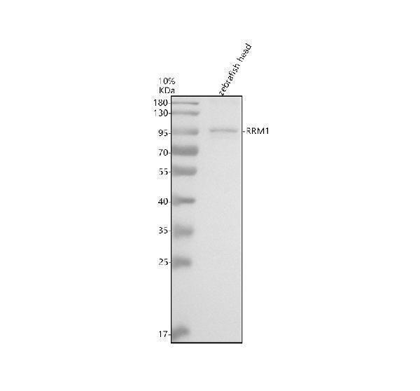 Western blot analysis of RRM1 using anti-RRM1 antibody (AZP79732)