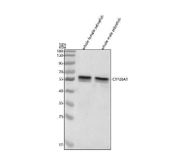  Western blot analysis of CYP26A1 using anti-CYP26A1 antibody (AZP79739)