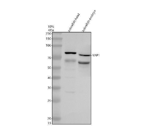 Western blot analysis of YAP1 using anti-YAP1 antibody (AZQ1L8J7)