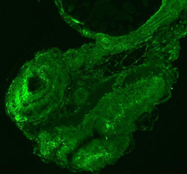 azq1lve8 sf3b3 primary antibodies if testing 1