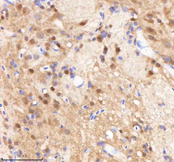 IHC analysis of SF3B3 using anti-SF3B3 antibody (AZQ1LVE8)