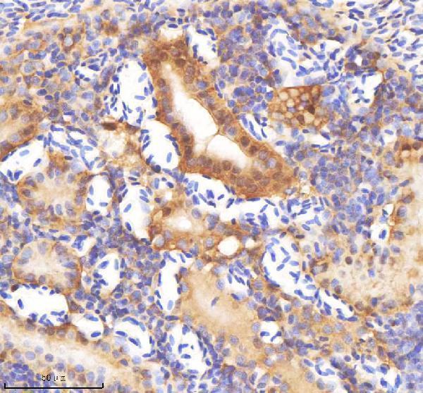 IHC analysis of SF3B3 using anti-SF3B3 antibody (AZQ1LVE8)