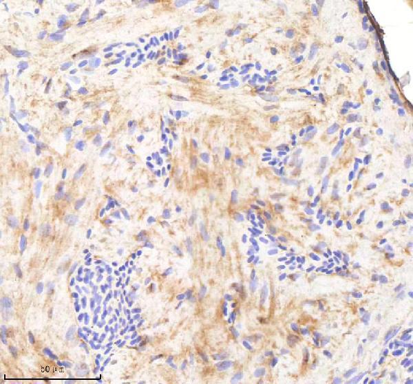 IHC analysis of SF3B3 using anti-SF3B3 antibody (AZQ1LVE8)