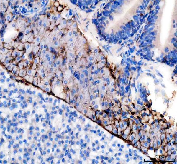 azq1mtc4 vtg2 primary antibodies ihc testing 4