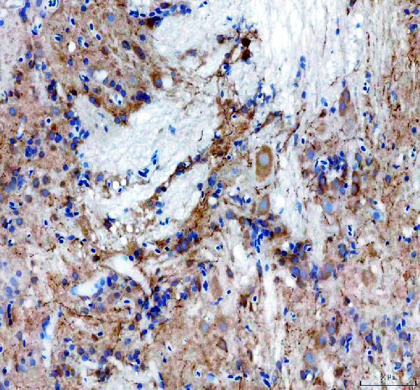azq1wgb5 slc6a4a primary antibodies ihc testing 2_1